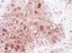 p62/SQSTM1 Antibody, Novus Biologicals 0.1mg; Unlabeled:Antibodies, Polyclonal